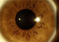 Di Digital attrezzatura oftalmica portatile non Mydryatic